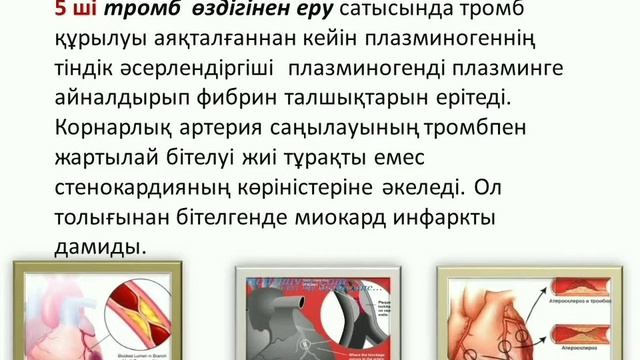 Тақырыбы: Миокард инфаркті. Оқытушы: Конирова С.К. смотреть онлайн