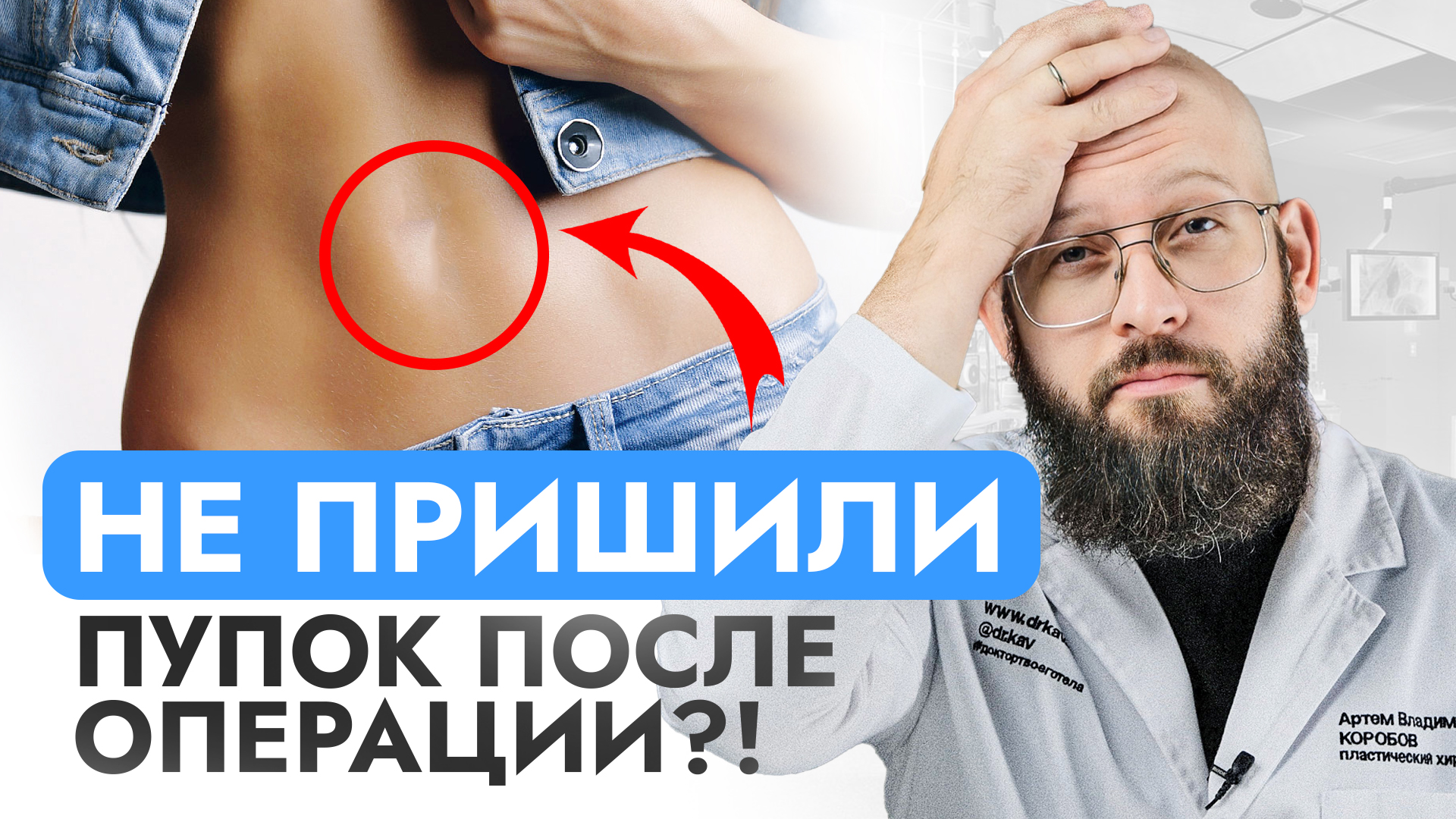 Сделали пластику живота, а Пупок забыли. Как выбрать пластического хирурга? смотреть онлайн