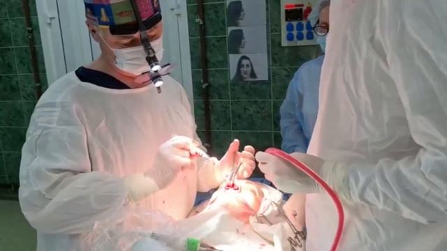 Ринопластика | Пластическая хирургия своими глазами. Выпуск 10 смотреть онлайн