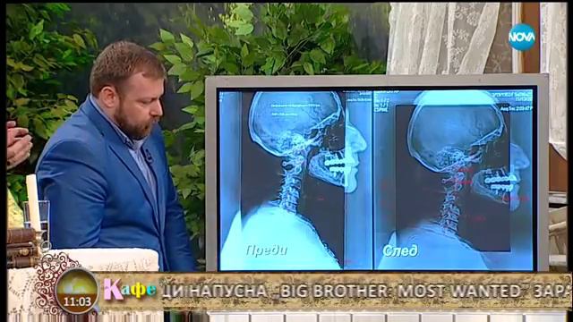 Как да избегнем гръбначи проблеми в натовареното ежедневие - На кафе (05.12.2017)