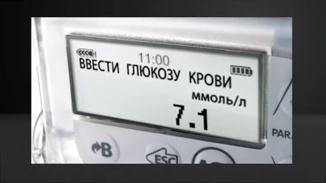 Что такое инсулиновая помпа и из чего она состоит? смотреть онлайн