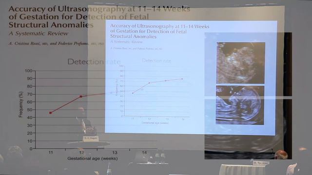 International Workshop on Prenatal Screening (PNS) 2017: Pyramid of Care – Importance of Ultrasound смотреть онлайн