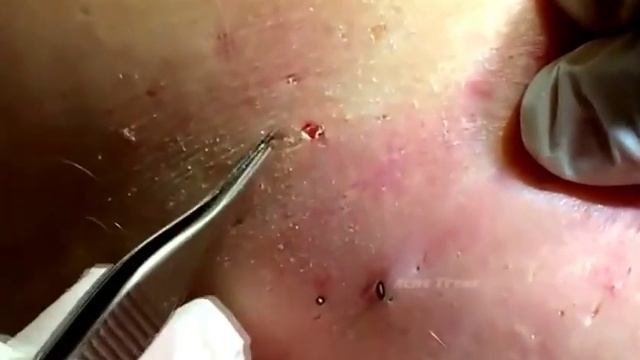 Жирные чёрные точки