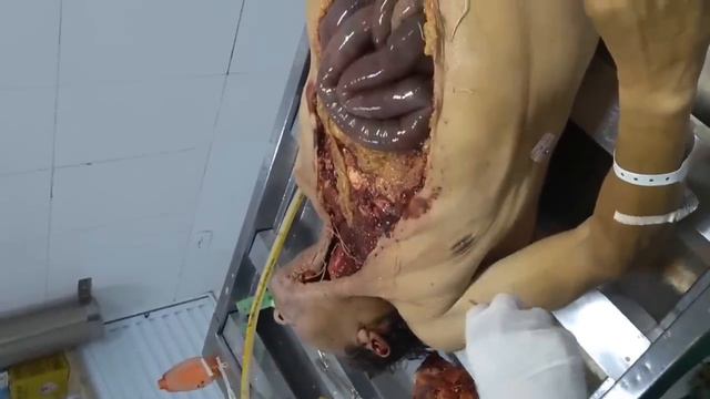 Necropsia , abrindo corpo do iml , tanatopraxia смотреть онлайн