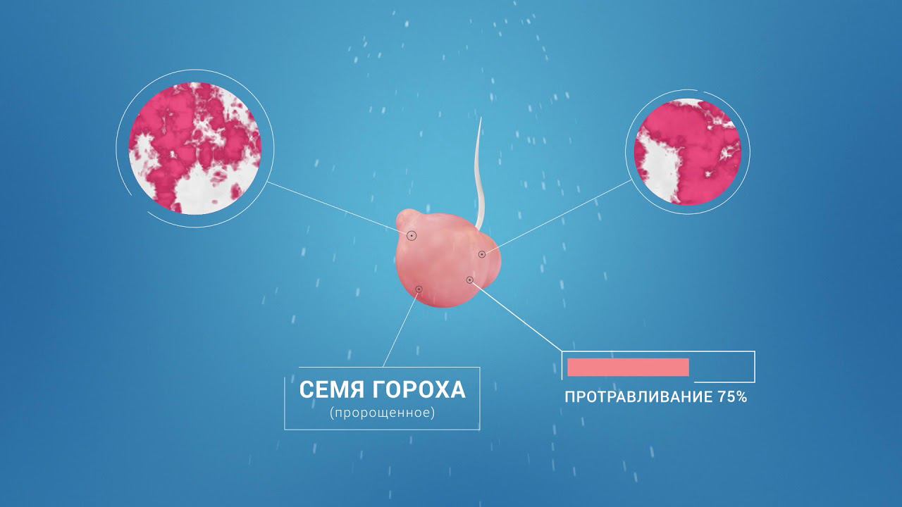 Редиго смотреть онлайн