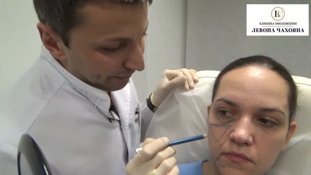 Консультация у Левона Чахояна