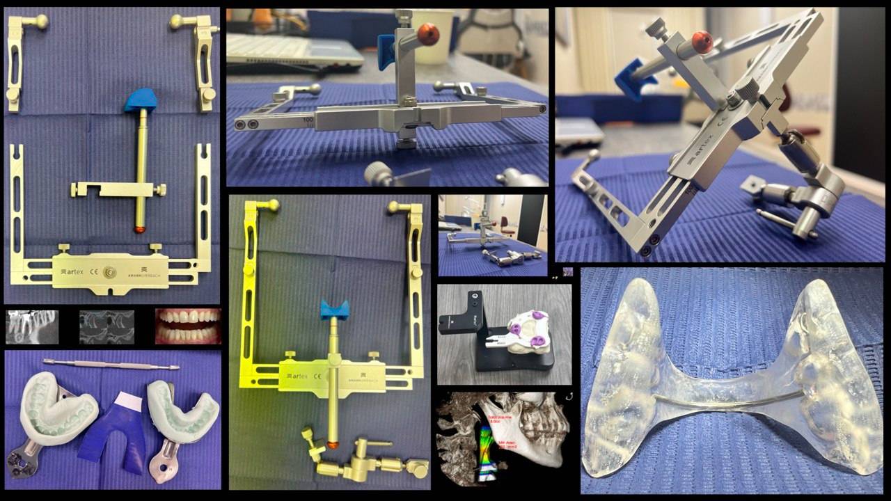 Стоматолог лечит стоматолога #0 - Оттиски, лицевая дуга, высота каппы - ДВНЧС - ВНЧС - НМР