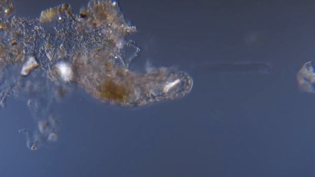 Тихоходка под микроскопом