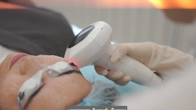 Фотоомоложение на аппарате IPL Lumecca by Inmode смотреть онлайн