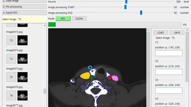 Open source Python NCC Auto ROI Example of using it. Pre-processing application. Medical DICOM, CT. смотреть онлайн