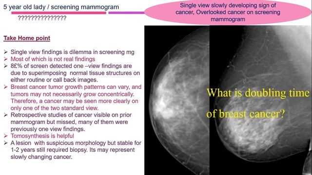 mammographic pitfalls and perals смотреть онлайн