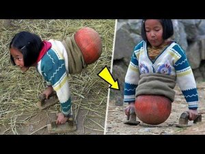 Уникальные Люди, Ставшие Примером Стойкости и Позитива