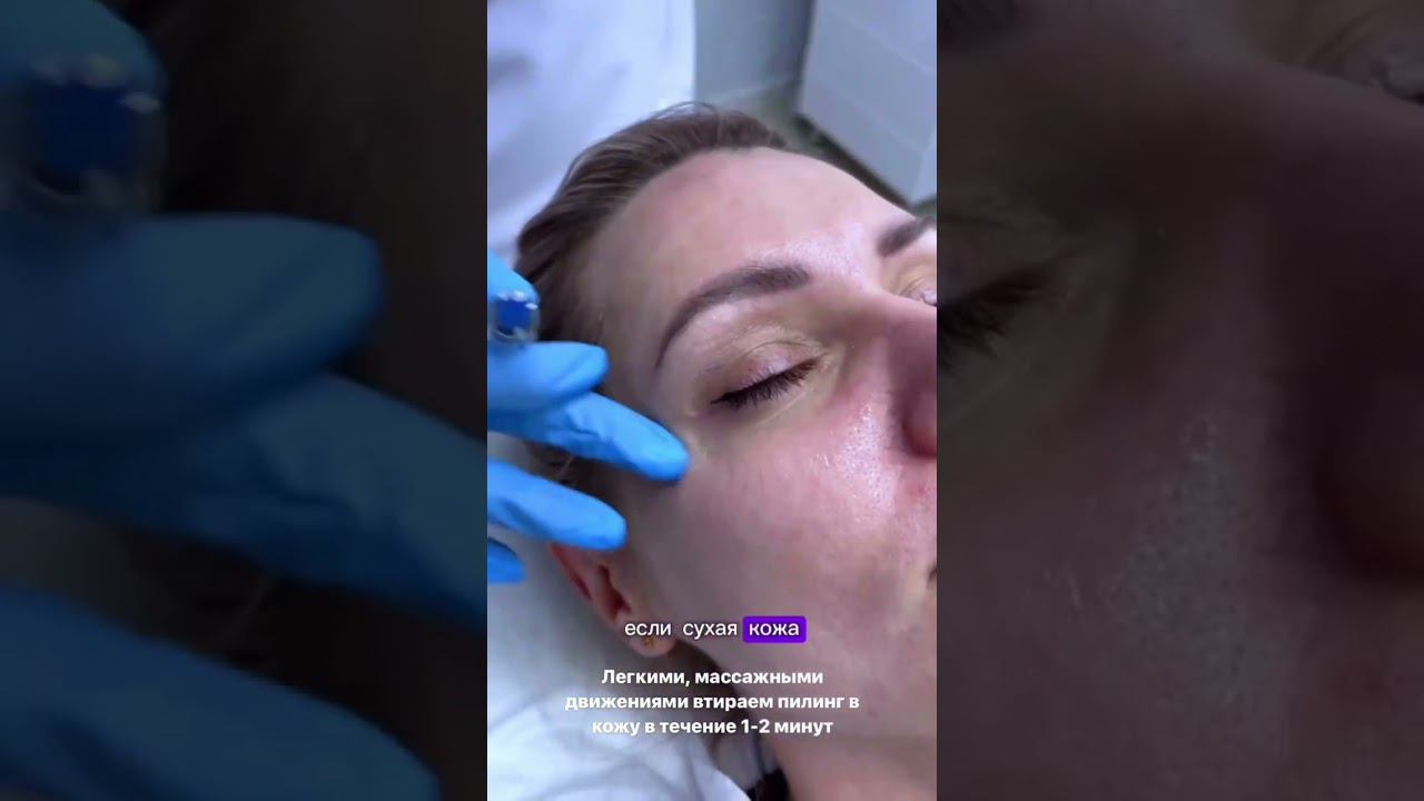 Kemikum нанесение смотреть онлайн