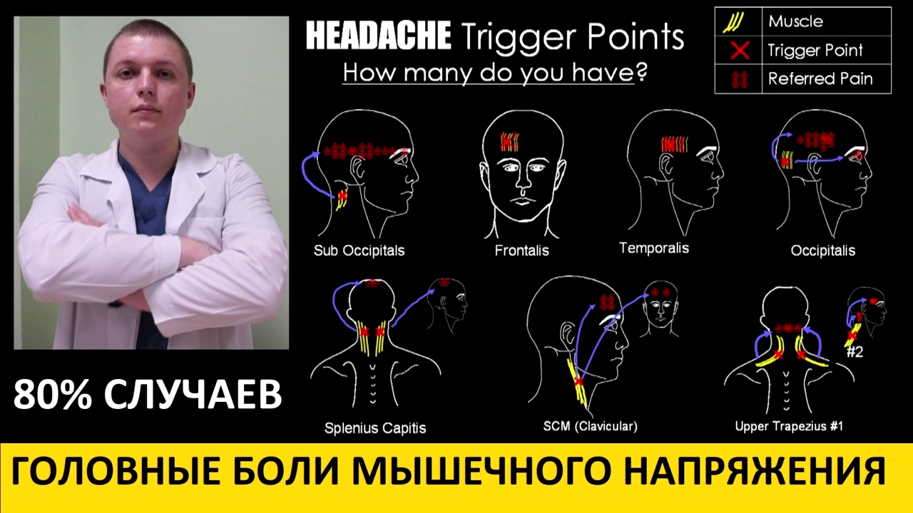 ГОЛОВНЫЕ БОЛИ МЫШЕЧНОГО НАПРЯЖЕНИЯ ОСОБЕННОСТИ ЛЕЧЕНИЕ Tension Headaches