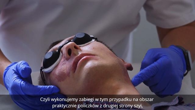 Leczenie naczyniaków i malformacji naczyniowych смотреть онлайн
