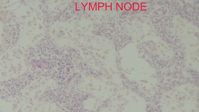 LYMPH NODES смотреть онлайн