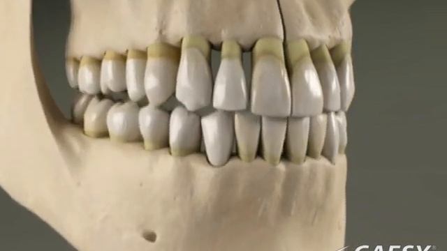 Denture Problems - Fort Lauderdale, FL смотреть онлайн