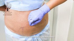 Криолиполиз - убираем жировые отложения. #косметология #криолиполиз #cristal #владивосток #клиника