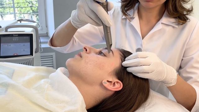 Лазерная полировка на аппарате Fotona смотреть онлайн