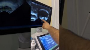 Сийганда ачишиш ва томчилаш давоси