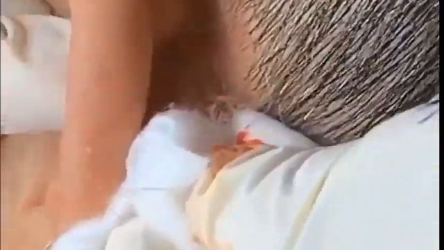 #23 Очень большой прыщ за ухом|Акне Black Acne, Pimple!!