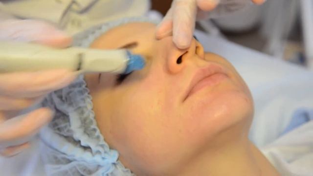 HydraFacial или вакуумный гидропилинг "Лазер Клиник" смотреть онлайн