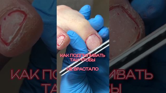 Как подпиливать чтобы не врастало #ногти #аппаратныйпедикюр #подолог смотреть онлайн