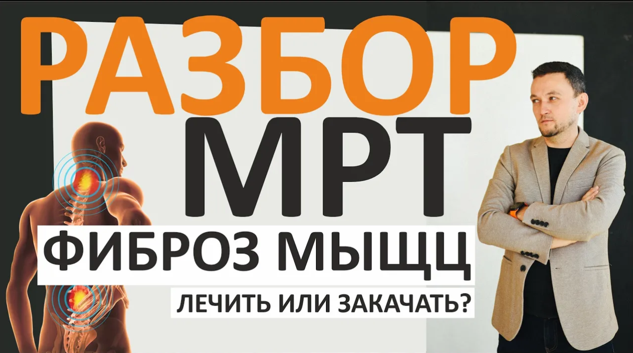 Болят мыщцы - мышечный корсет нужен или нет?