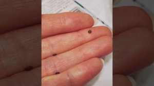 МИМОЗА СТЫДЛИВАЯ -выращиваю необычное растение из семян