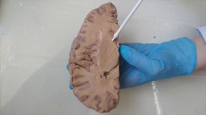 Белое вещество головного мозга , базальные ядра, капсулы, боковые желудочки