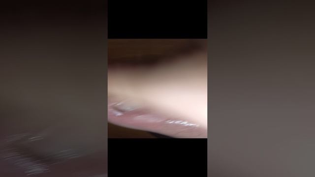 вросший ноготь.mp4