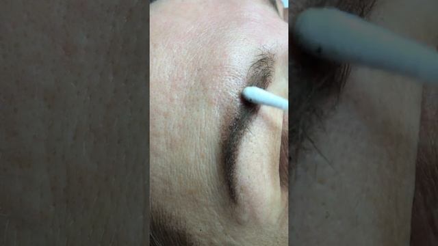 Брови в процессе заживления на 7й день. Межресничка свежая. смотреть онлайн