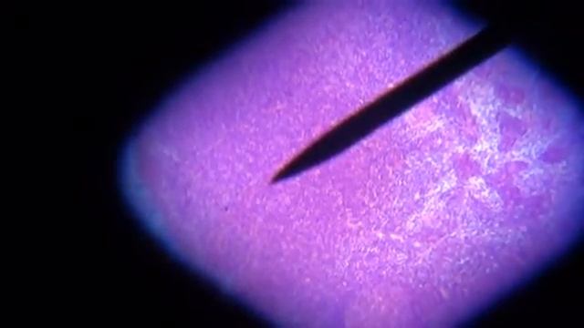 LYMPH NODE SLIDE смотреть онлайн