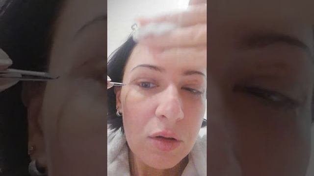 Снимаю швы после блефаропластики