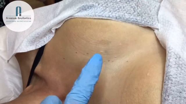 ФОТОЛЕЧЕНИЕ НА АППАРАТЕ - М22. 04.06.2019. смотреть онлайн