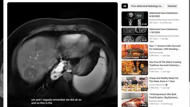 Abdominal Case Conference - 2/6/2024 смотреть онлайн