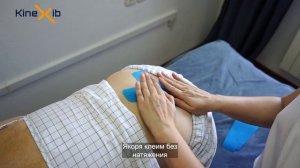 Тейпирование при боли в спине
