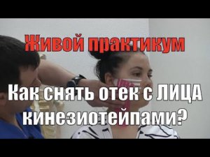 Как просыпаться без отека на лице? Кинезиотейпирование лица