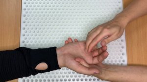 Оценка состояния кисти. Предположительно компрессия в кубитальном канале.