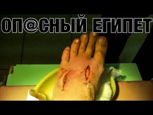 Египет._Хургада._Кого_бояться_в_Красном_море