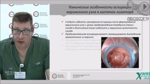 Лигирование варикозно расширенных вен пищевода (запись прямой трансляции)