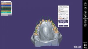 моделировка искусственной десны в "экзокаде" - как включить функцию ?