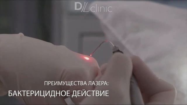 Пластика уздечки верхней губы лазером в DLclinic смотреть онлайн