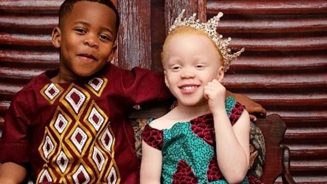 Женщина родила совершенно непохожих близнецов. И вот почему смотреть онлайн