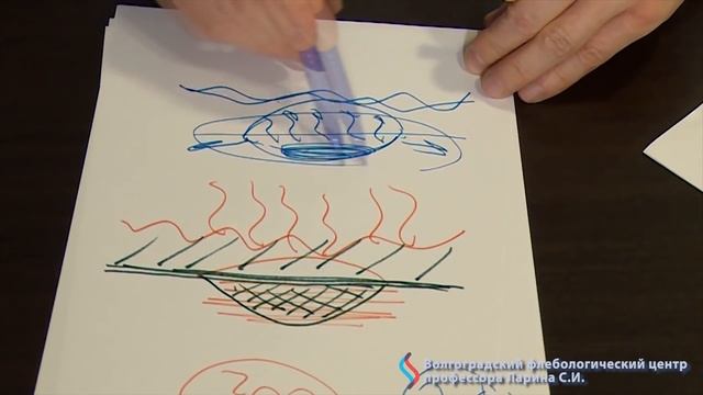 Базалиома. Что это? смотреть онлайн