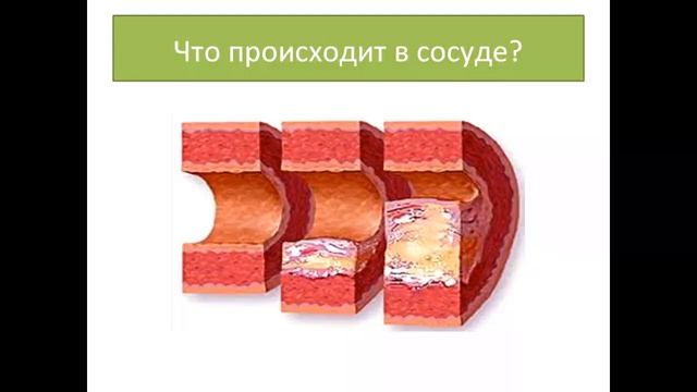 тоник смотреть онлайн