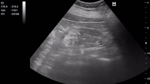 Вот такие почки смотреть онлайн