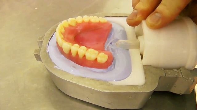 Съемный протез смотреть онлайн