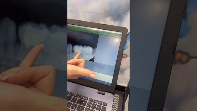 Катя первый раз у стоматолога. Как космонавт. Январь 2023 смотреть онлайн