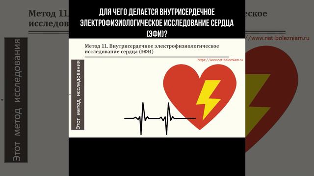 Для чего делается внутрисердечное электрофизиологическое исследование сердца? #сердце #эфи #кардио